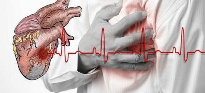 Острый геморрагический цистит: причины, симптомы и лечение у женщин и мужчин