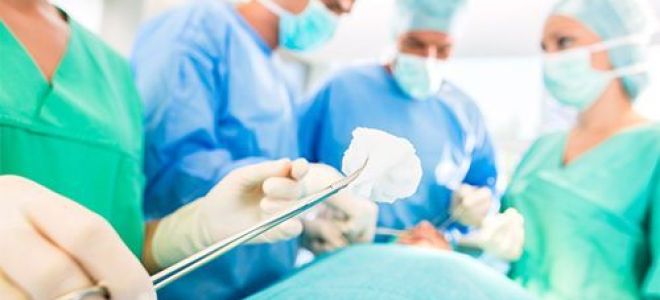 Лейкоплакия мочевого пузыря: причины, симптомы, лечение