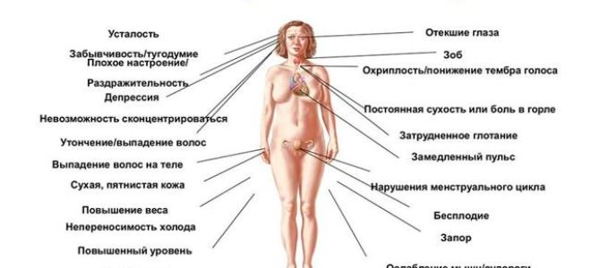 Гипокортицизм: симптомы, диагностика, лечение и прогноз