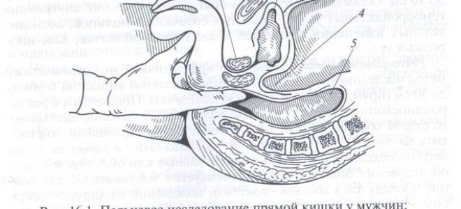 Кто такой уролог и что он лечит, виды урологических заболеваний