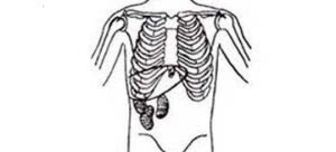 Нефроптоз 2 и 3 степени: причины, симптомы, лечение и прогноз