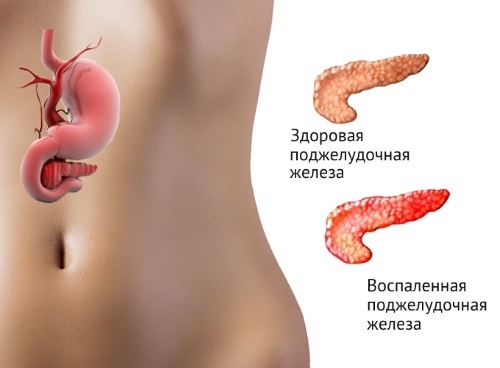 Повышенная амилаза мочи и крови у мужчин женщин и детей: норма, причины, диагностика