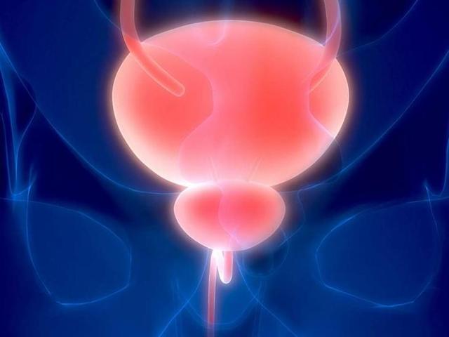 Полипы в мочевом пузыре у женщин: симптомы и лечение заболевания