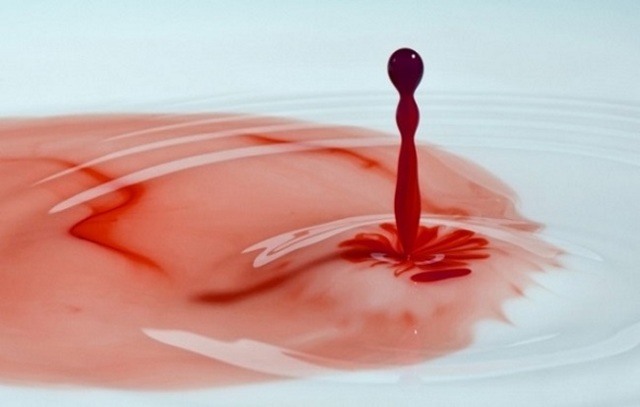 Причины крови с болью при мочеиспускании у мужчин и женщин: уретроррагия