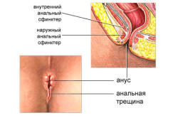 Жжение и боль в мочевом пузыре у женщин и мужчин: лечение