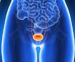 Гиперактивный мочевой пузырь у женщин, мужчин и детей: причины, симптомы, лечение