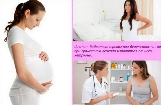 Фурадонин: при беременности на разных сроках и лактации