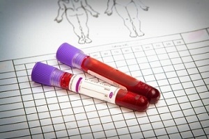 Анализ крови на цистатин С: показатели нормы, причины повышения