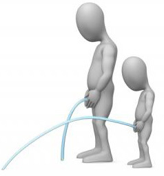 Слабая струя при мочеиспускании у мужчин: причины, диагностика, лечение, профилактика