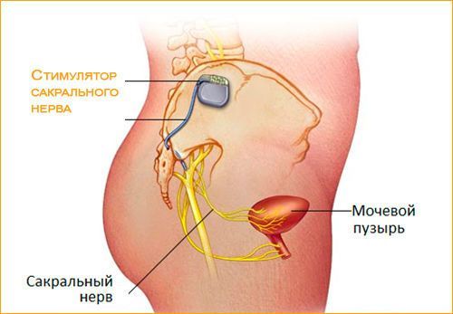 Остаточная моча в мочевом пузыре у женщин, мужчин и ребенка: в норме по УЗИ, лечение