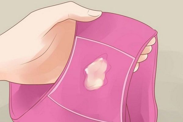 Неприятный запах и выделения из уретры у женщин: причины, диагностика, лечение