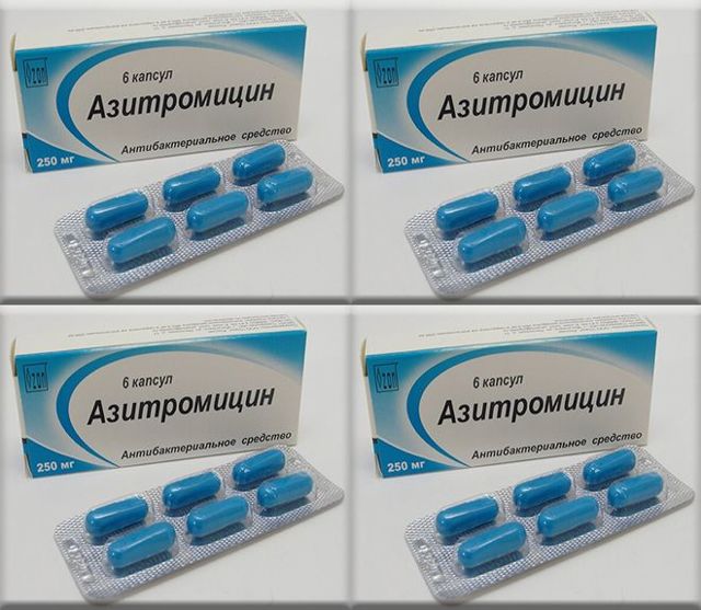 Азитромицин при цистите у женщин: как принимать, отзывы вачей и пациентов