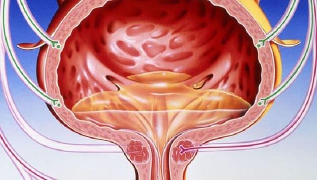 Нейрогенный мочевой пузырь – причины, симптомы, лечение женщин и мужчин