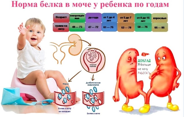 Повышенный белок в моче у ребенка: норма (таблица), причины, лечение